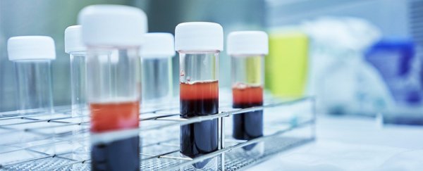 Moderna's COVID-19 vaccine booster appears effective against Omicron variant