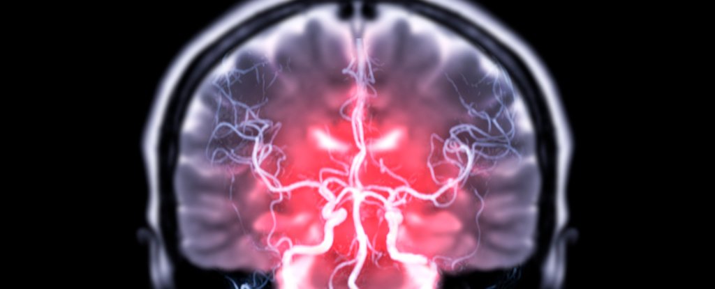 Scientists Have Finally Discovered Why The Brain Consumes So Much Energy, Even a..