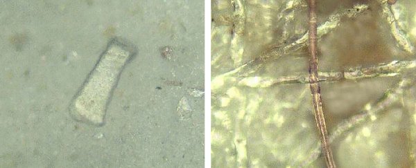 Study finds alarming levels of microplastics in the feces of people with IBD