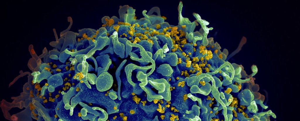 Cancer Drug Flushes Out Latent HIV, Exciting New Study Finds