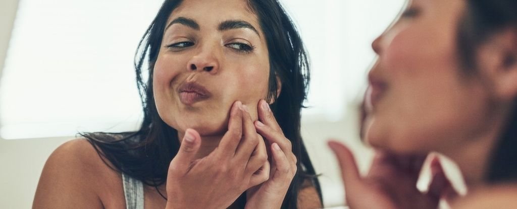 Fat Cells in Our Skin Could Be Key to Fighting Acne, Scientists Discover