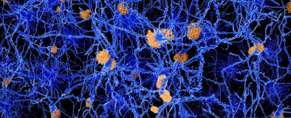 We just got closer to finding a link between Alzheimer's and circadian rhythms