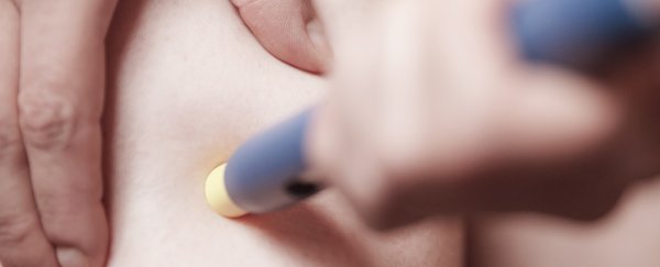 We just got a major clue on how CGRP contributes to migraine in our nerve cells
