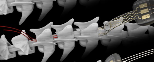 Spinal Implant Enables Paralyzed Man With Severed Spine to Walk Again