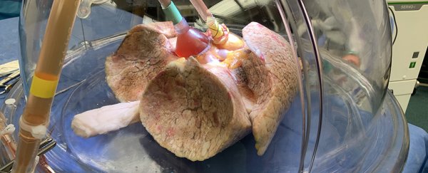 Scientists convert donor lungs to universal blood type in a medical first