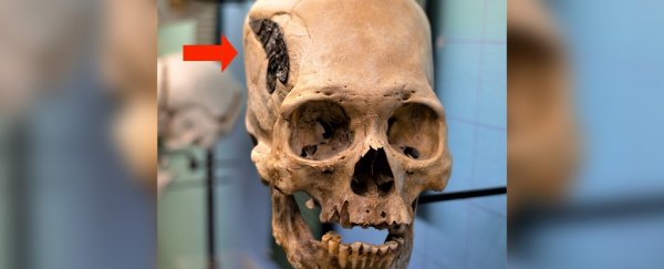 Mysterious skull implanted with strange metallic object divides experts