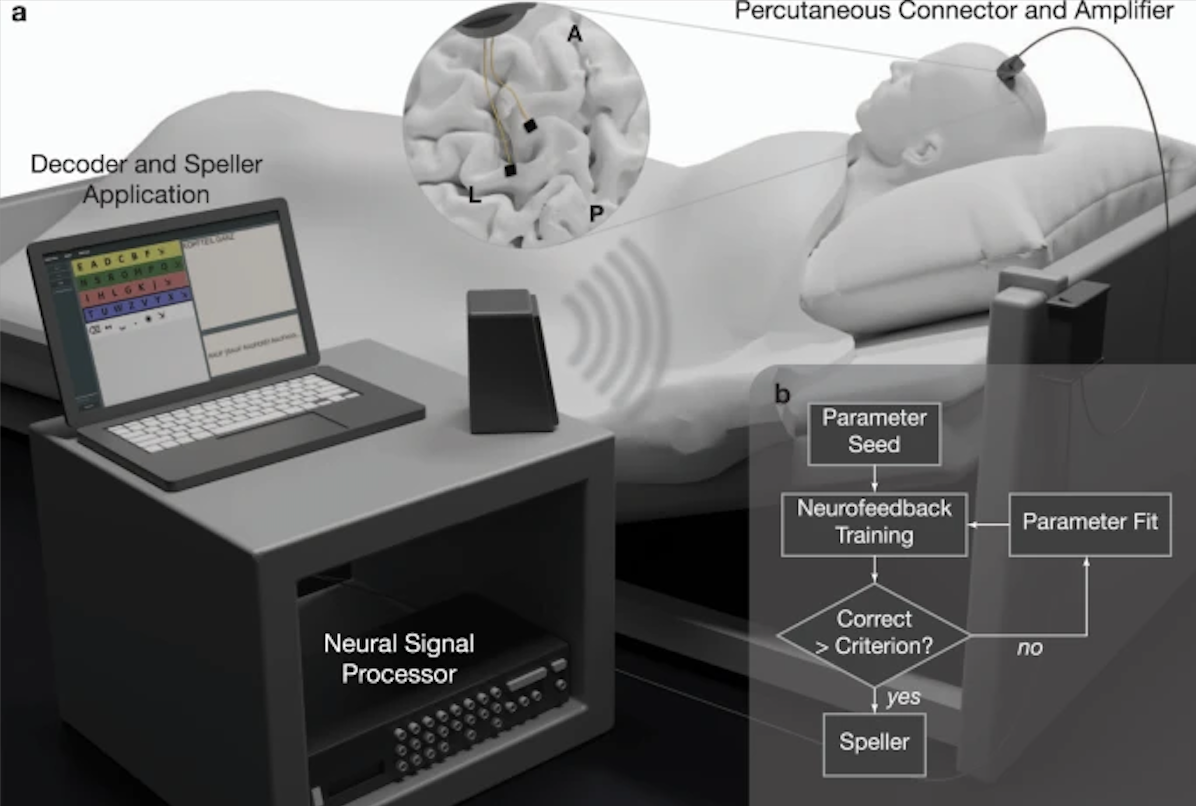 ExperimentalSetUpBrainImplant