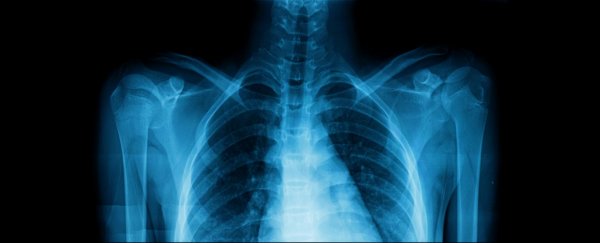 How a 19th-century breakthrough could revolutionize COVID-19 diagnosis