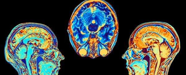 MRI scans of healthy brains