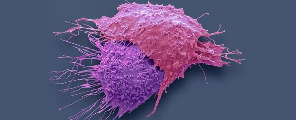 Ovarian cancer cells. 
