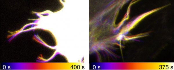 Your cells have weird 'tentacles' that help them move around. Here's how they work