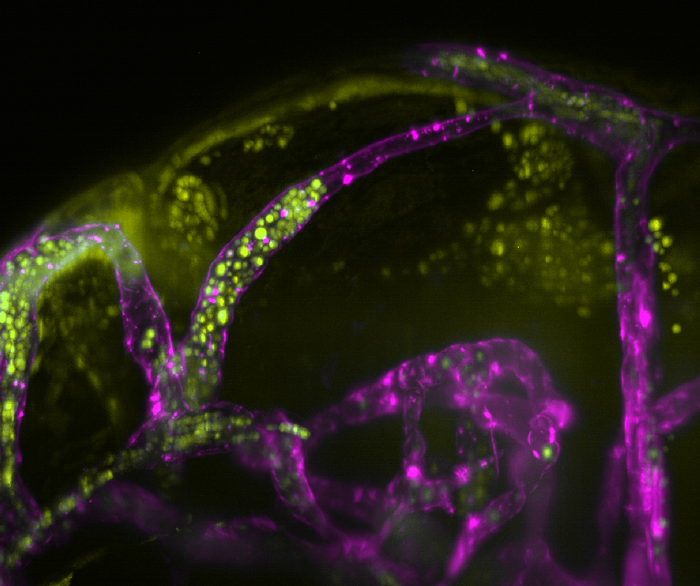 Brain blood vessels infected with C. neoformans