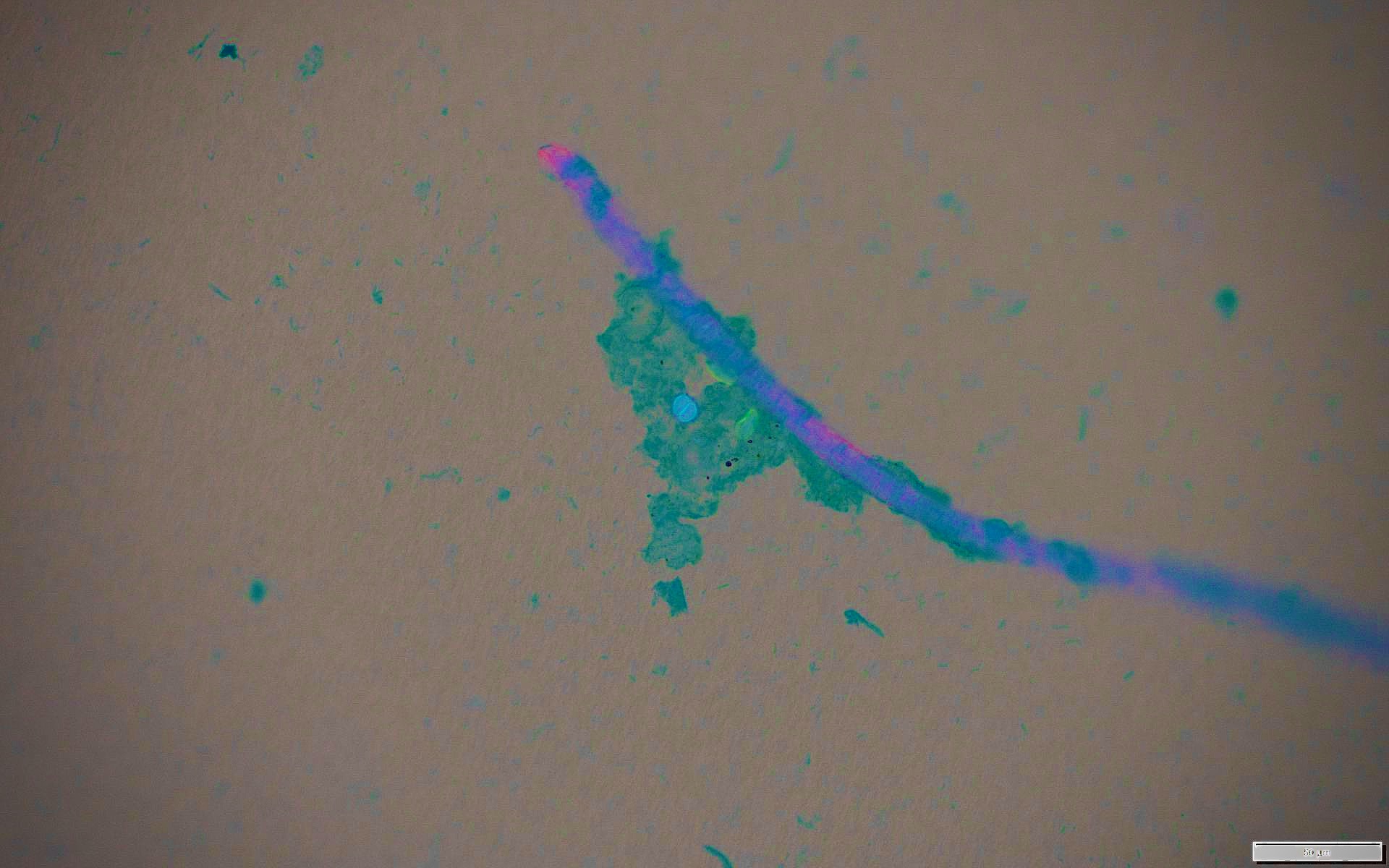 microplastic fiber and pathogens pic UC Davis