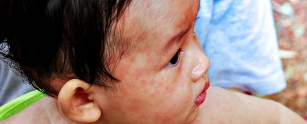 A child's face with measles rash