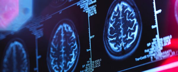 Scientists Used Over 100,000 MRIs to Map The Human Brain Across Our Entire Lifetime