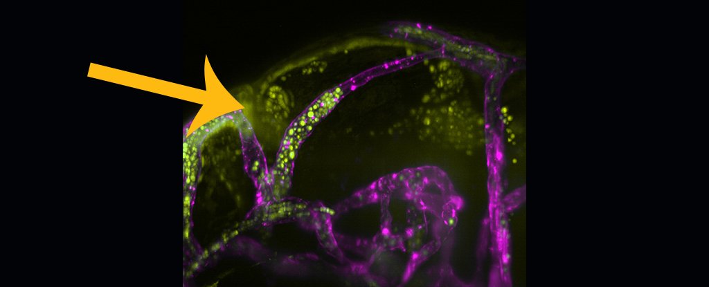 Finalmente sabemos cómo se propaga la mortal meningitis fúngica en el cerebro, y es brutal