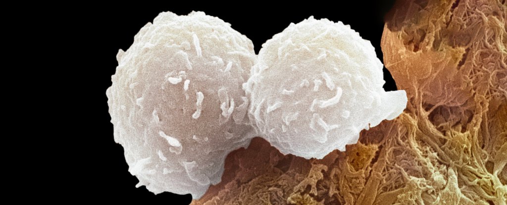 White B cells like these can go rogue and start attacking 'self'. 
