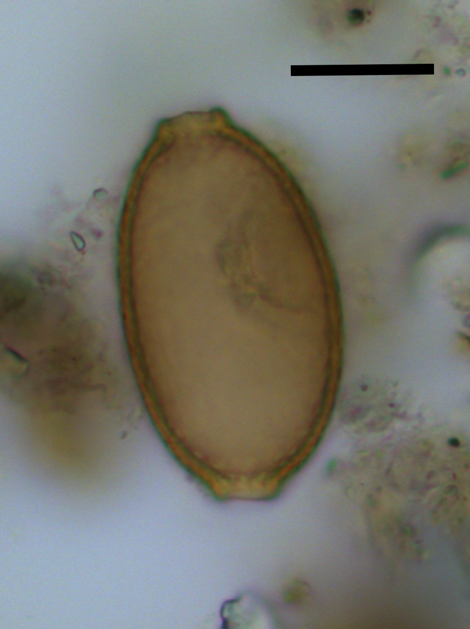 Capillariid Egg