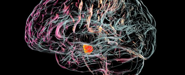 Scientists have pinpointed the brain cells that die in Parkinson's disease