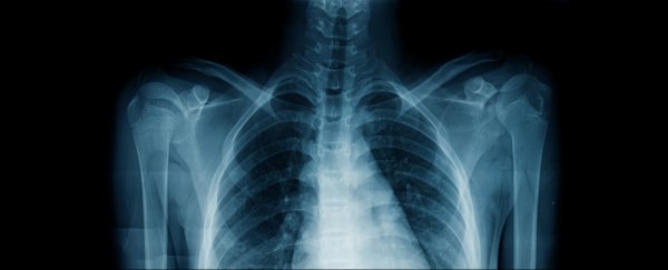 AI can predict people's race from X-ray images, and scientists are concerned