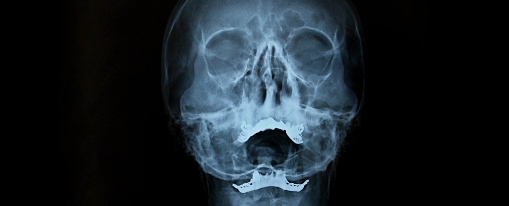 Tiny Channels Discovered Inside The Human Skull Could Be Vital For The Brain