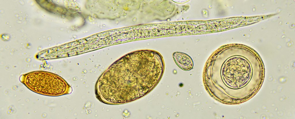 Parasitic worms and their eggs in a poop sample. 