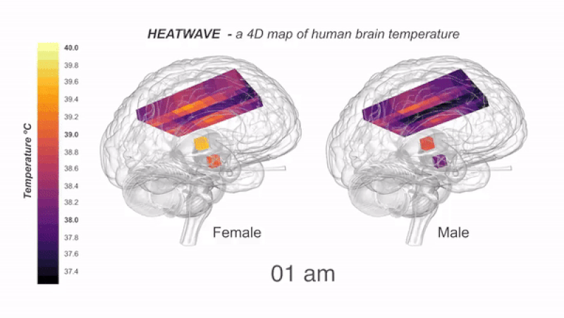 The Human Brain Runs Way Hotter Than We Ever Realized, Scientists Find :  ScienceAlert