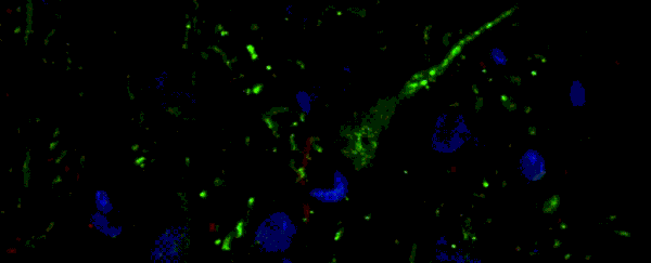Scientists find surprising neuron differences between primates and non-primates