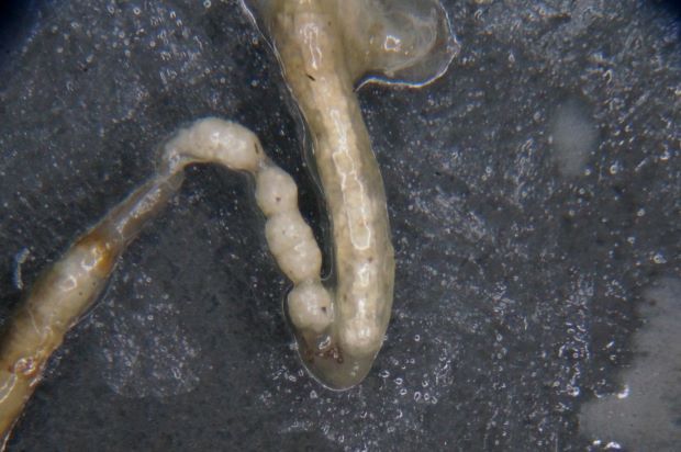 White substance visible through the gut walls of a worm