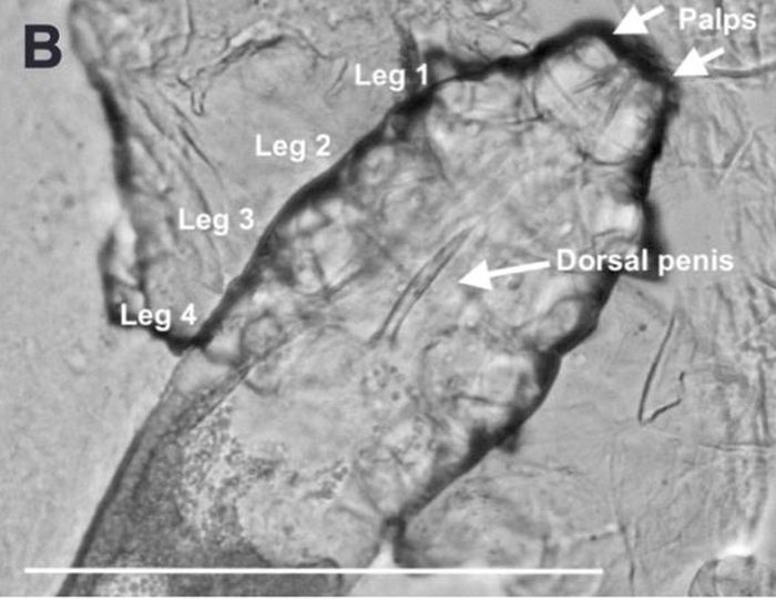 demodex folliculorum dorsal penis