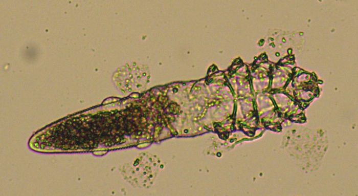 demodex underside