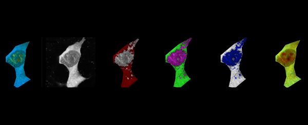Proteins involved in Alzheimer's can 'overcook' cells through heat, study finds