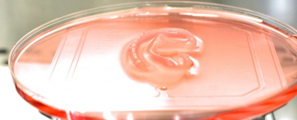 Surgeons transplanted a lab-grown ear from patient's own cells in early clinical trial