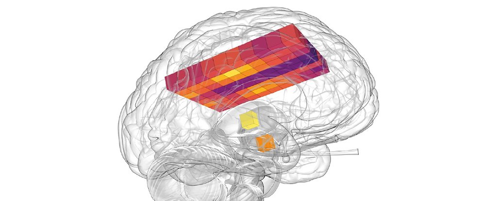 A map of human brain temperature. 