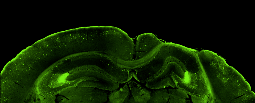 A mouse brain tissue section shows changes eight weeks after injury 