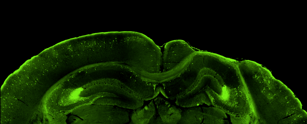 Las lesiones en la cabeza pueden reconfigurar las redes de todo el cerebro en ratones, revelan nuevos mapas importantes