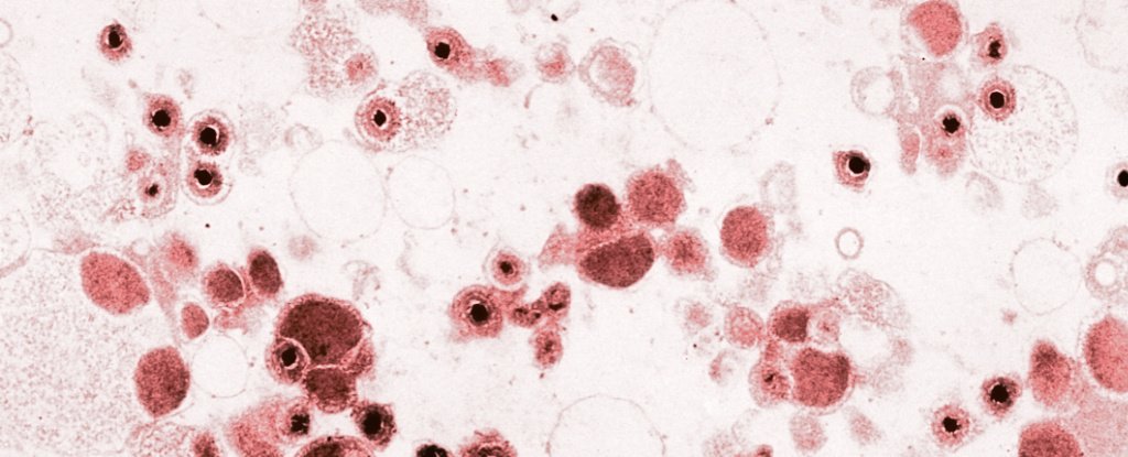 False coloured electron microscope image of Cytomegalovirus. 