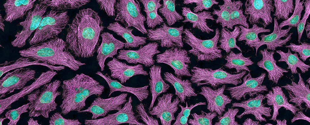 What Are HeLa Cells? A Cancer Biologist Explains The Controversy That Cannot Die