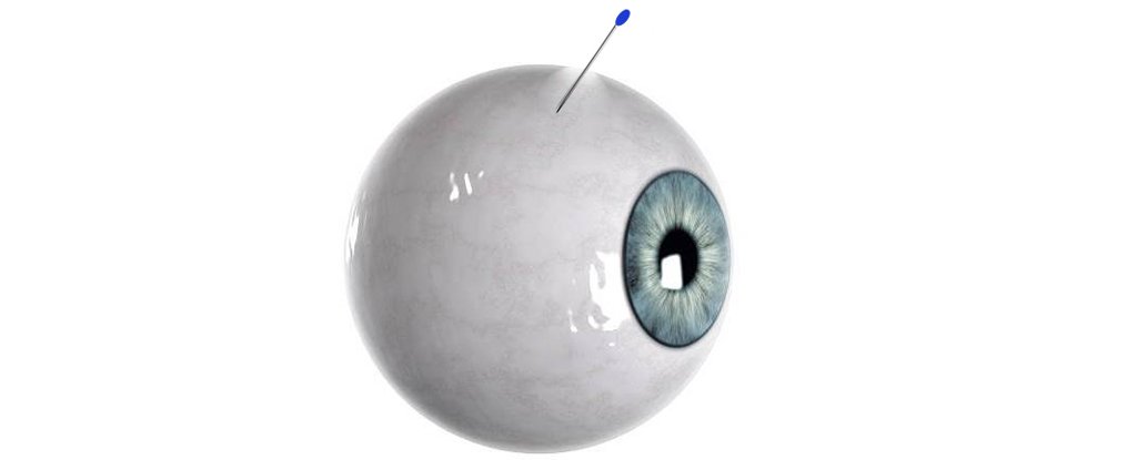 Scientists Created a 'Self-Plugging' Eye Microneedle, And It's as Creepy as It S..
