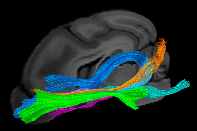 Gray brain on black background with differently colored bunches of strands running through it.