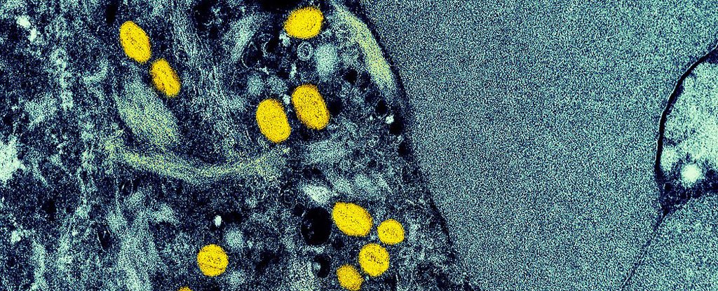 Monkeypox Declared a Public Health Emergency in US as Outbreak Spreads