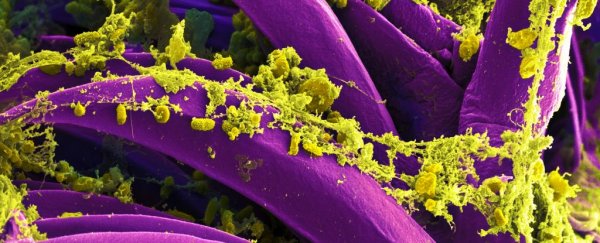 Extinct pathogens ushered the fall of ancient civilizations, scientists say