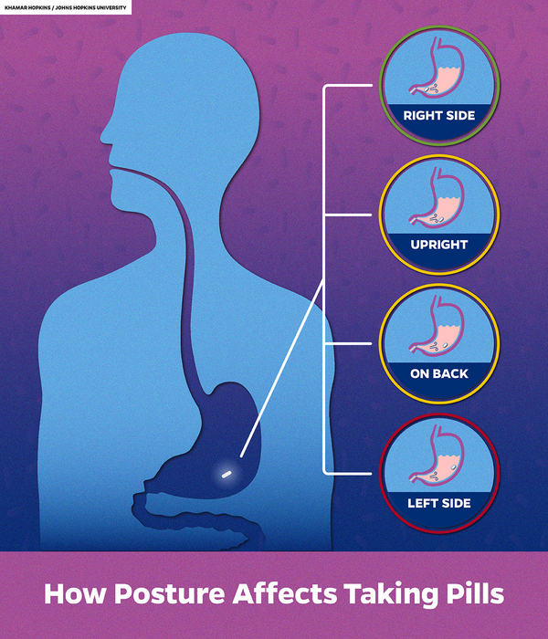 Infographic showing how stomach anatomy and posture affect pill absorption and digestion.