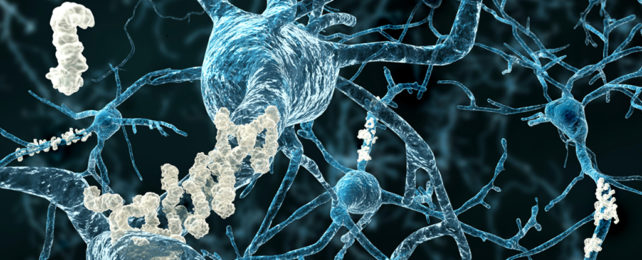 CGI image of a neuron with a white plaque