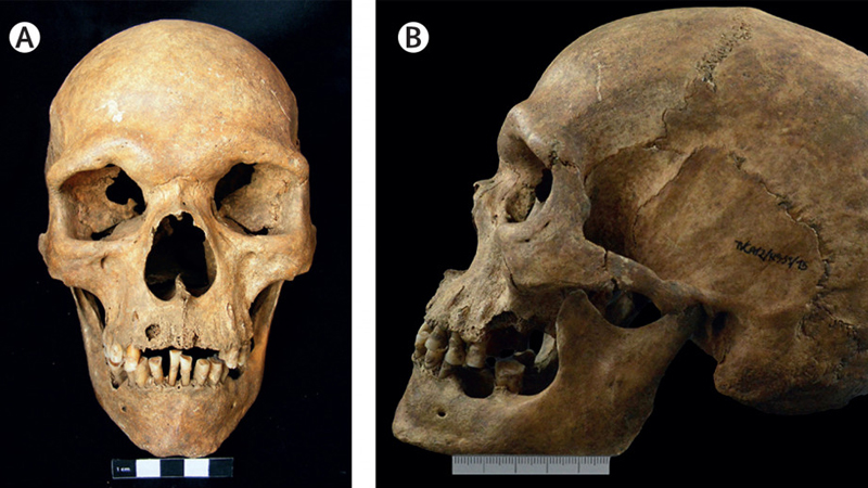 Skull shown from front and side