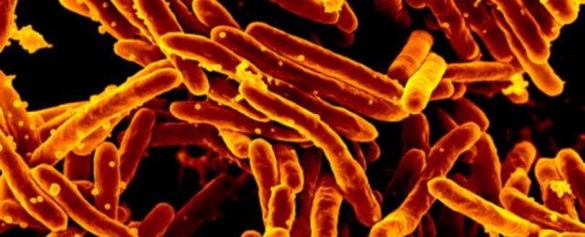 Tuberculosis Bacteria Under Microscope