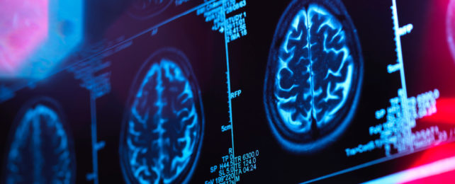 Brain scan images displayed on an illuminated light box in medical clinic.