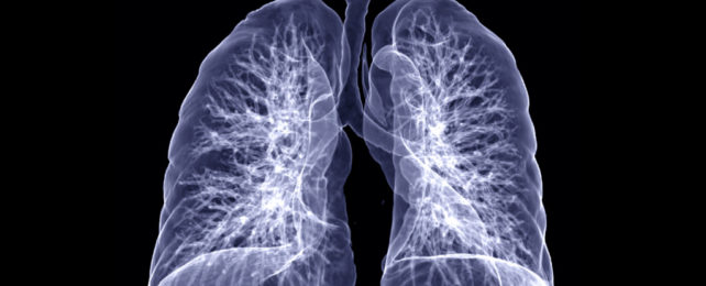3D rendering of lung CT scan