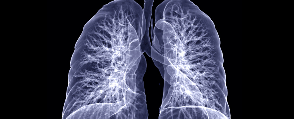 Still Short of Breath? Here Are 3 Ways COVID-19 Can Damage Lungs Long Term - ScienceAlert