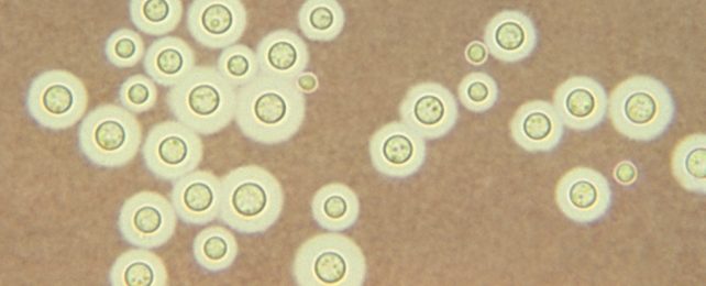 Cryptococcus neoformans